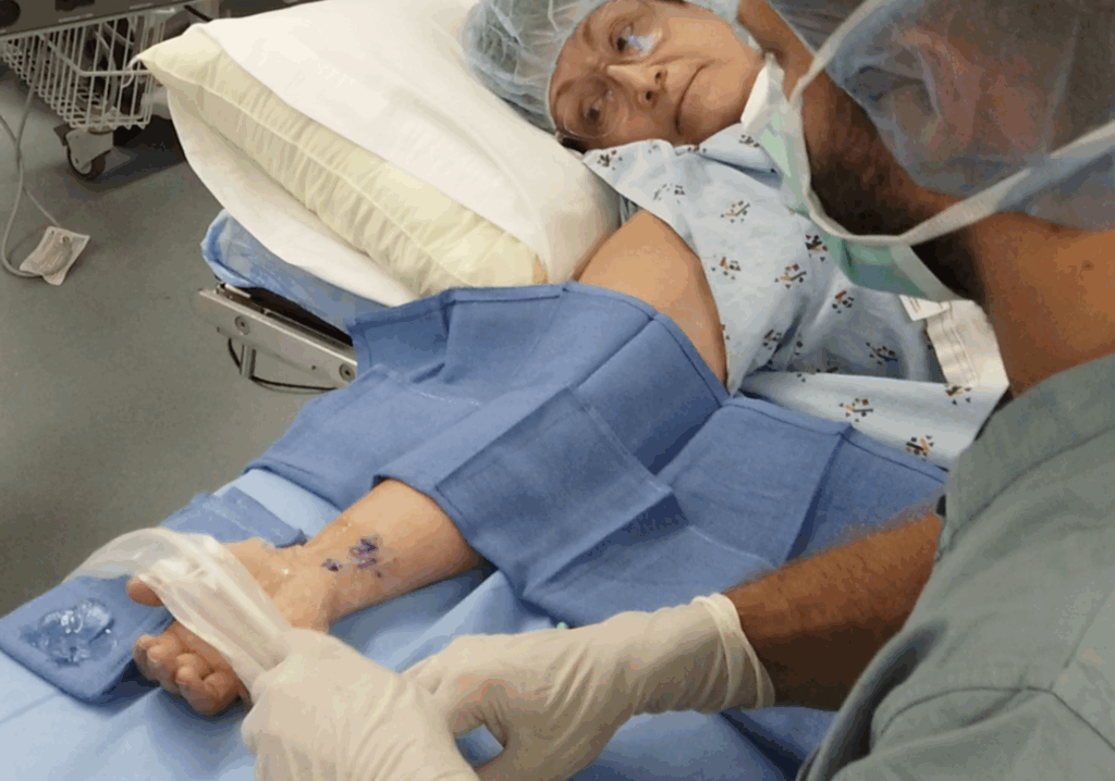 How Does a Carpal Tunnel Release Work?