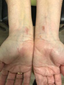 sonexhealed